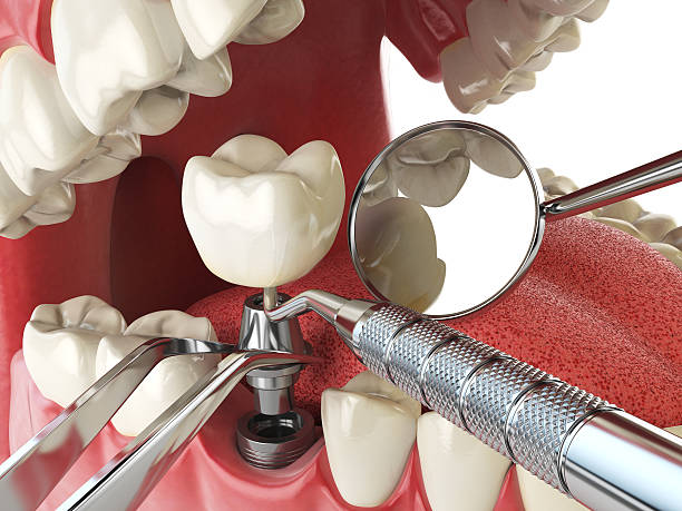Best Emergency Treatment for Jaw Pain or Injury in Ansted, WV